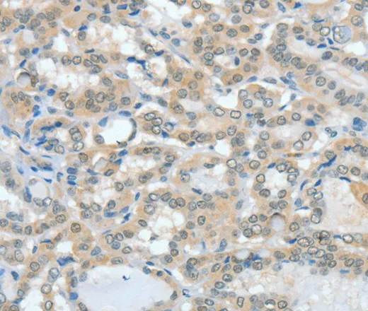 ASH2L Polyclonal Antibody - image 1