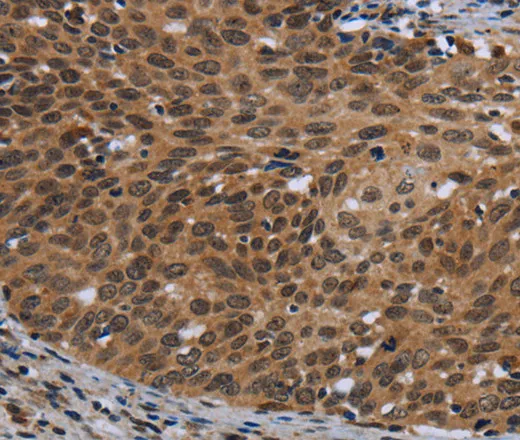 CEBPD Polyclonal Antibody - image 1