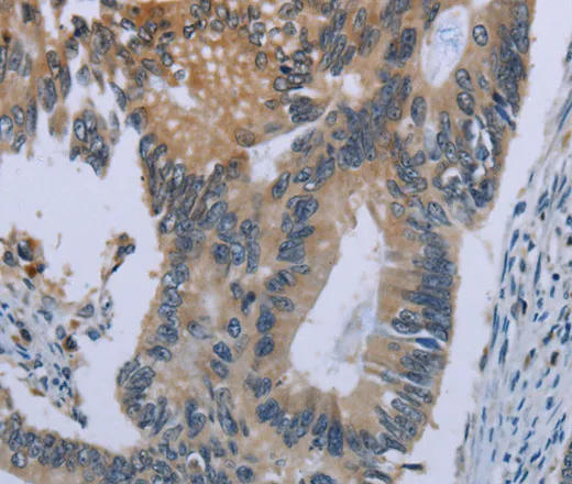 CEBPD Polyclonal Antibody - image 2