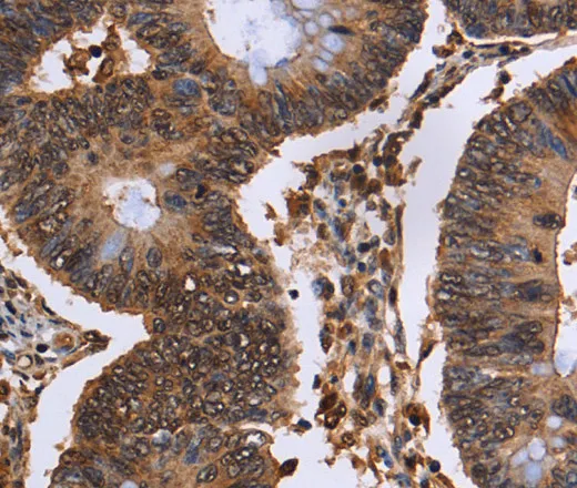 EXTL3 Polyclonal Antibody - image 1