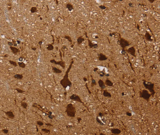 KARS Polyclonal Antibody - image 1