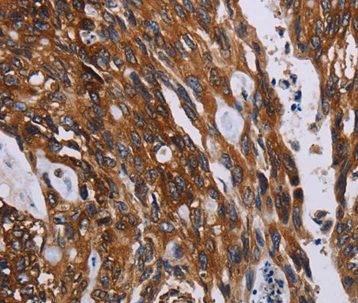 KARS Polyclonal Antibody - image 2
