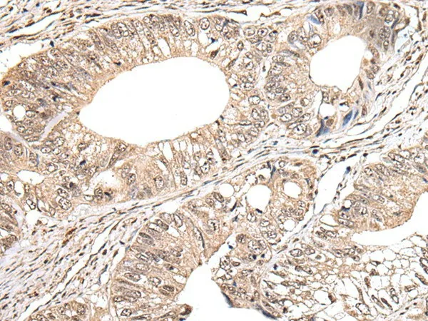 METAP1D Polyclonal Antibody - image 1