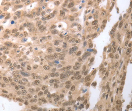 RAD52 Polyclonal Antibody - image 1