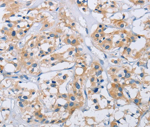 CCR9 Polyclonal Antibody - image 1