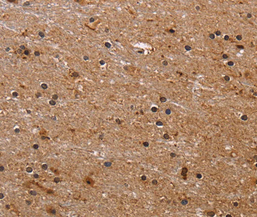 FBP2 Polyclonal Antibody - image 1
