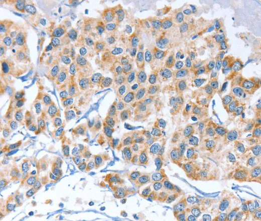 APOBEC3D Polyclonal Antibody - image 1