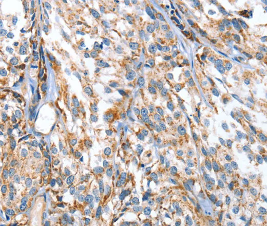 APOBEC3D Polyclonal Antibody - image 2