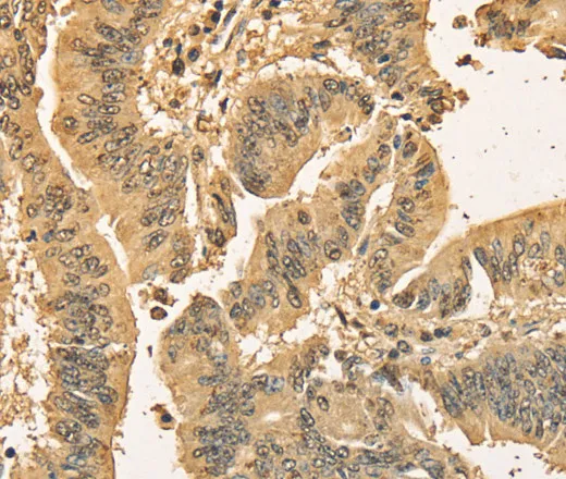 CDCA8 Polyclonal Antibody - image 1