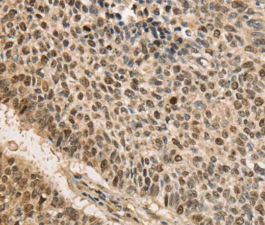CDCA8 Polyclonal Antibody - image 2