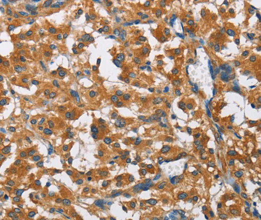 COPB1 Polyclonal Antibody - image 1