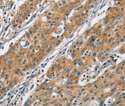 COPB1 Polyclonal Antibody - image 2