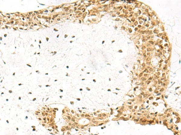 EXOSC4 Polyclonal Antibody - image 1