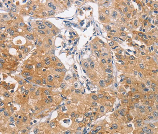 CDCA4 Polyclonal Antibody - image 1