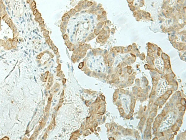 ETAA1 Polyclonal Antibody - image 1