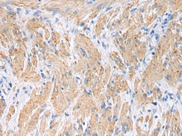 FBXO45 Polyclonal Antibody - image 1