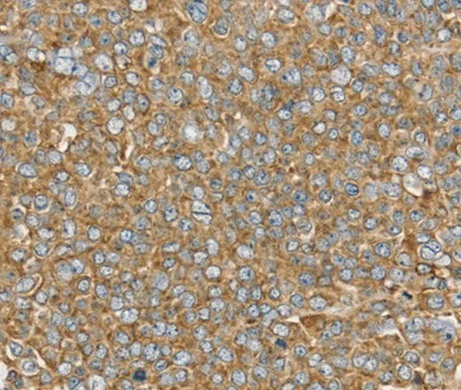 PTGER2 Polyclonal Antibody - image 1