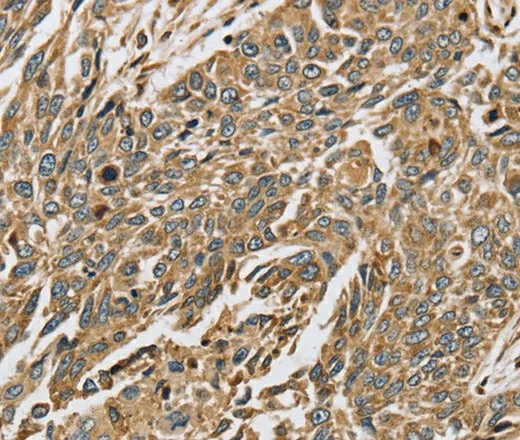 PTGER2 Polyclonal Antibody - image 2