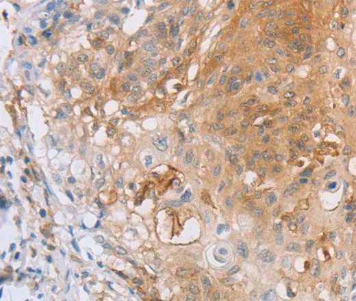 CD85d Polyclonal Antibody - image 1