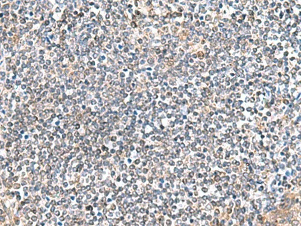 ITGA3 Polyclonal Antibody - image 1