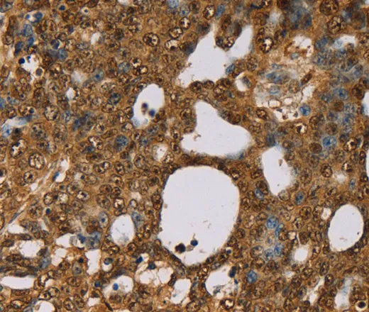 PSMC2 Polyclonal Antibody - image 1