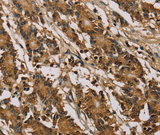 PSMC2 Polyclonal Antibody - image 2