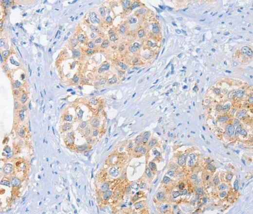 BRCA1 Polyclonal Antibody - image 1