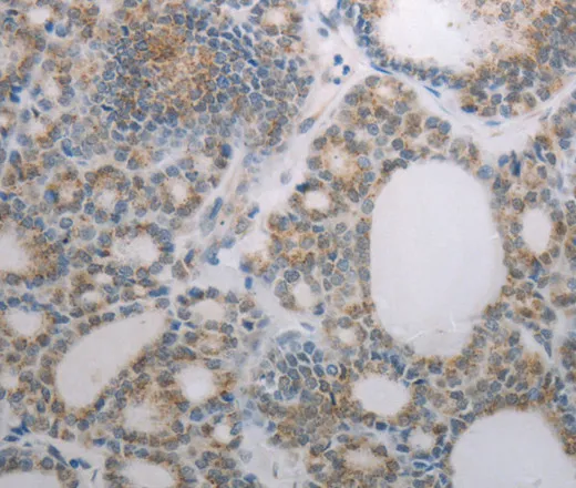 RBMS3 Polyclonal Antibody - image 1