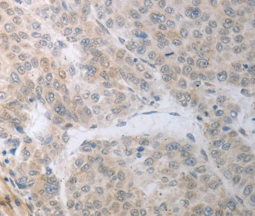 RBMS3 Polyclonal Antibody - image 2