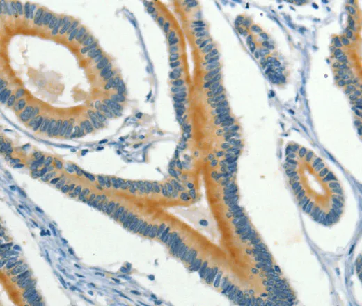 KLC1 Polyclonal Antibody - image 1