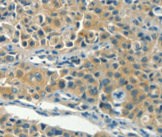 KLC1 Polyclonal Antibody - image 2