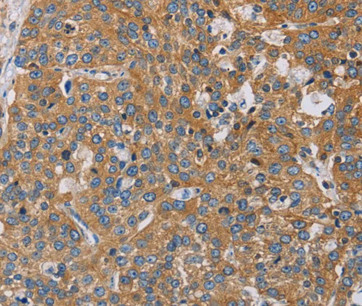 ACTN4 Polyclonal Antibody - image 1