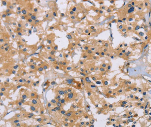 ACTN4 Polyclonal Antibody - image 2