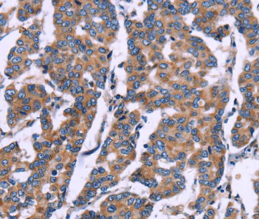 ZEB2 Polyclonal Antibody - image 1