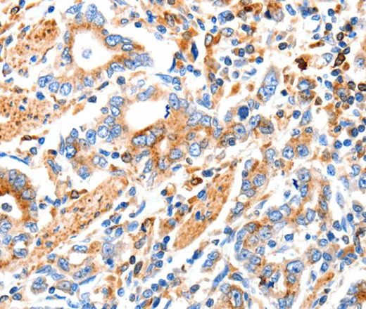 MAP2K2 Polyclonal Antibody - image 1