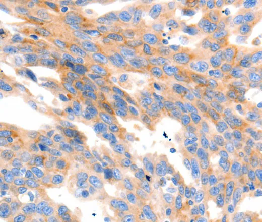 MAP2K2 Polyclonal Antibody - image 2