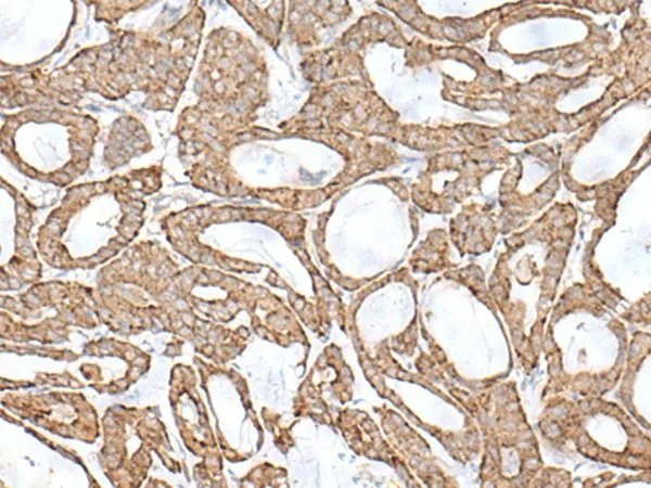 RNF111 Polyclonal Antibody - image 1