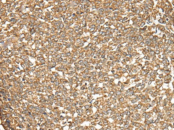 C5AR1 Polyclonal Antibody - image 1