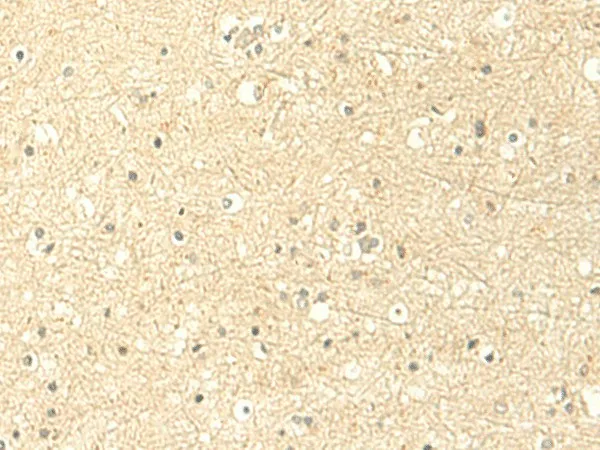 MTHFS Polyclonal Antibody - image 1