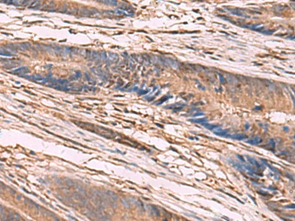 KCNN2 Polyclonal Antibody - image 1