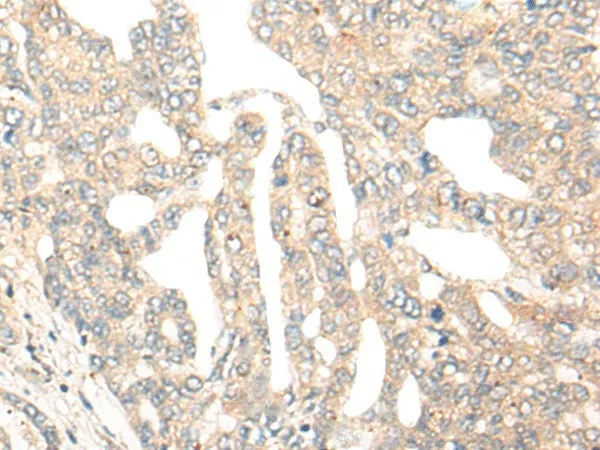 DCP2 Polyclonal Antibody - image 1