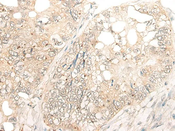 DCP2 Polyclonal Antibody - image 2