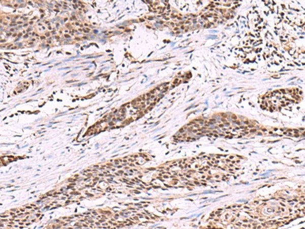 CUL4A Polyclonal Antibody - image 1