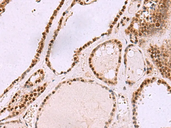 CUL4A Polyclonal Antibody - image 2