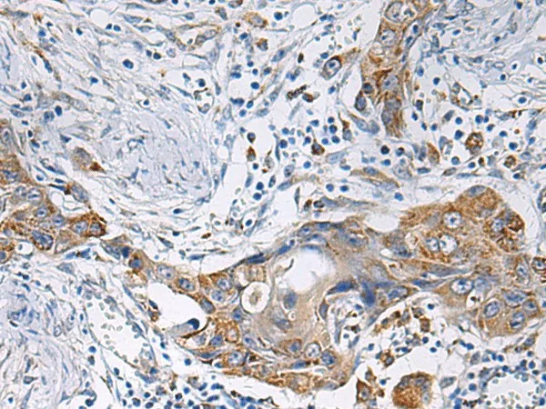HSDL2 Polyclonal Antibody - image 1