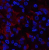 RUNX2 Polyclonal Antibody - image 1