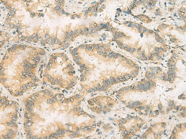 RAB13 Polyclonal Antibody - image 1