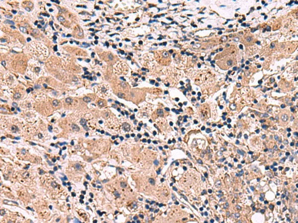 INSC Polyclonal Antibody - image 1