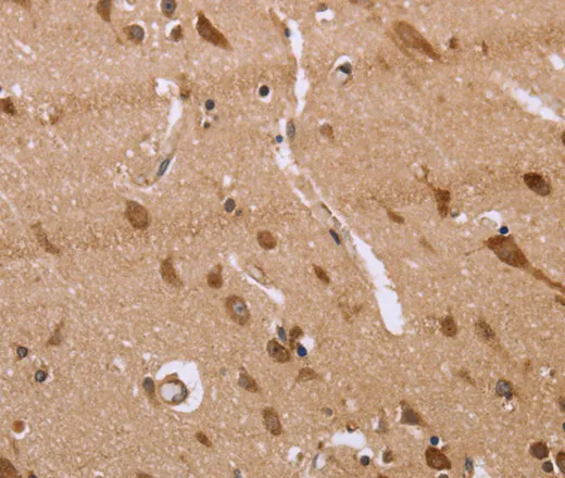 FAAH2 Polyclonal Antibody - image 1