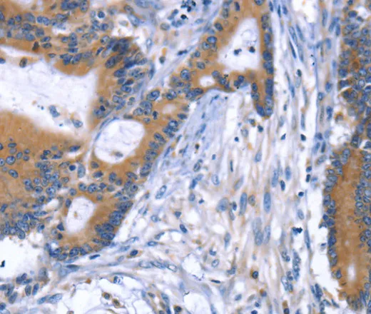 ARRB1 Polyclonal Antibody - image 1